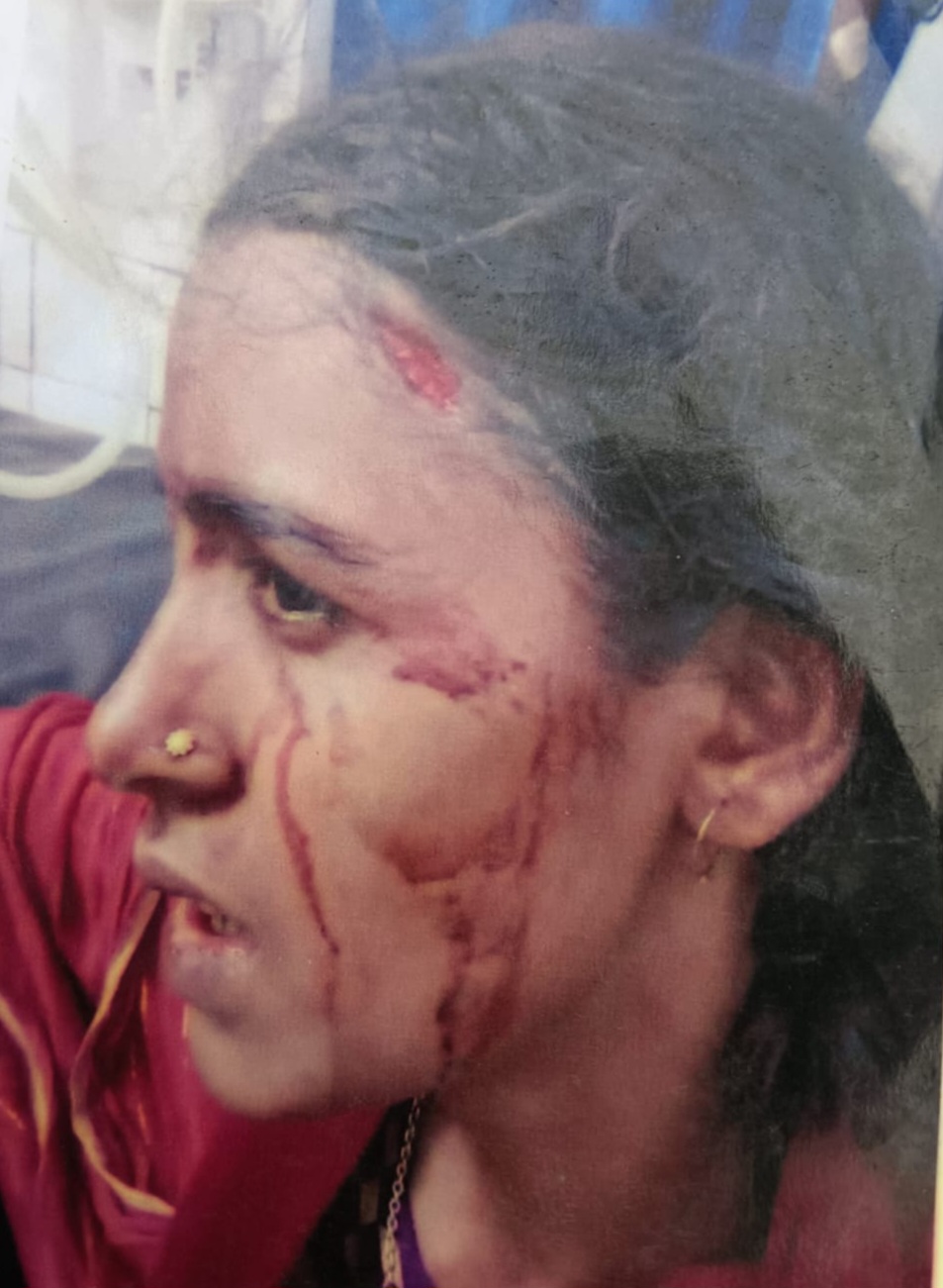 শিবপুরে দুই পরিবারের বিরোধে চরম উত্তেজনা