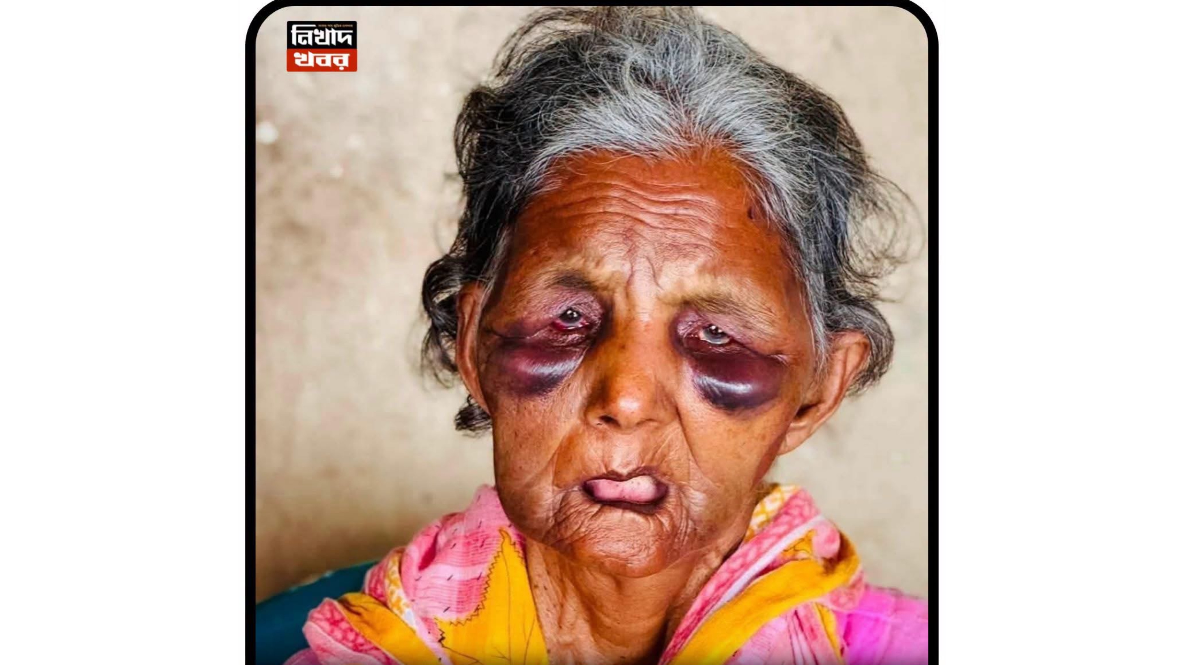 মাদকসেবীদের নির্মম নির্যাতনের শিকার সেই বৃদ্ধার মৃত্যু