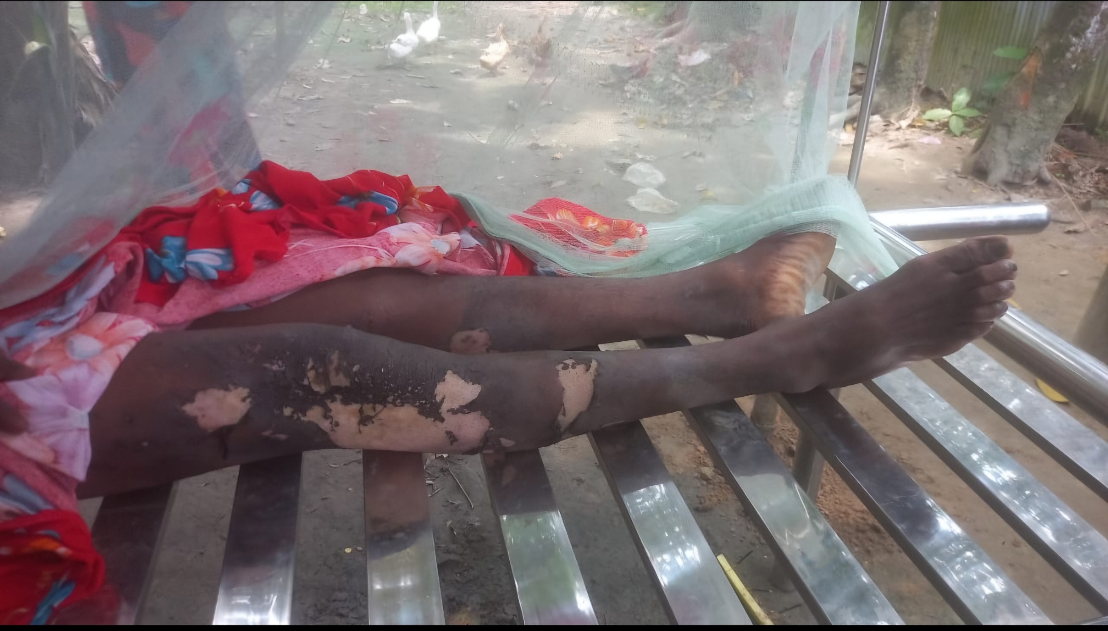 গাইবান্ধার গোবিন্দগঞ্জে বিদ্যুৎস্পৃষ্টে দুইজনের মৃত্যু